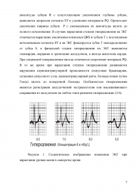 Изменеия ЭКГ при электролитных нарушениях и влиянии некоторых лекарственных препаратов Образец 4906