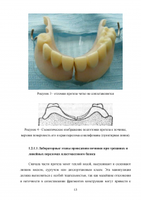 Особенности проведения починок съёмных протезов в современных технологических условиях Образец 53391