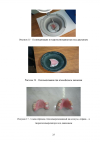 Особенности проведения починок съёмных протезов в современных технологических условиях Образец 53403