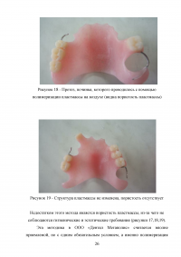 Особенности проведения починок съёмных протезов в современных технологических условиях Образец 53404