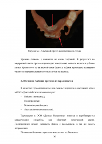 Особенности проведения починок съёмных протезов в современных технологических условиях Образец 53408