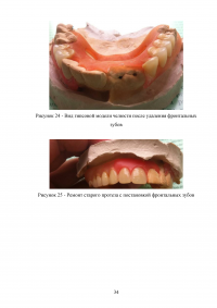 Особенности проведения починок съёмных протезов в современных технологических условиях Образец 53412