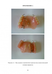 Особенности проведения починок съёмных протезов в современных технологических условиях Образец 53442