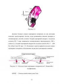 Организация скорой медицинской помощи при остром коронарном синдроме Образец 55093