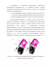 Организация скорой медицинской помощи при остром коронарном синдроме Образец 55090