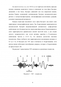 Физиологические механизмы сна, их возрастные особенности Образец 66225